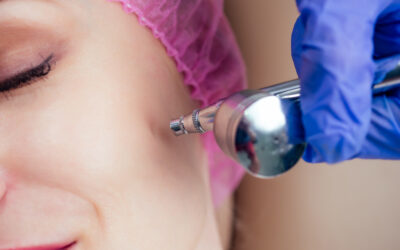 Cool Confidence: Embrace Youthful Skin with Cryoskin Facials