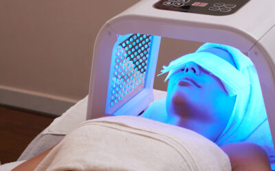 The Role of Blue Light Therapy in Acne Treatment